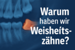 Warum schwitzt man?